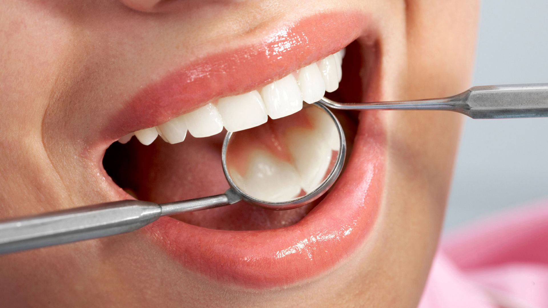 Гигиена полости рта